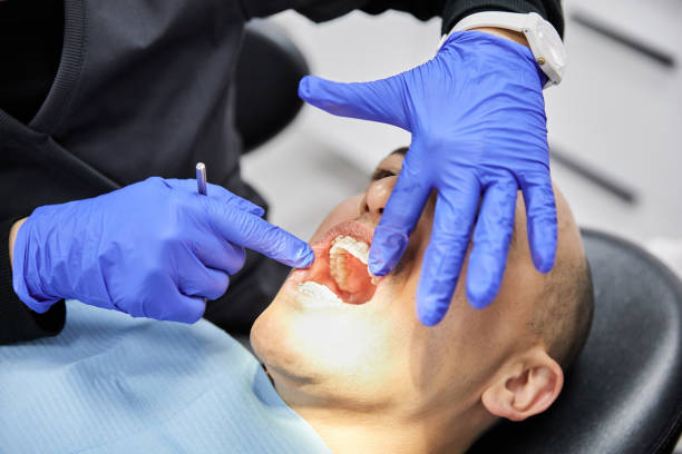 Best Emergency Denture Repair in Clarksburg, WV